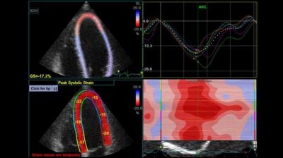 GE Healthcare Logiq P9