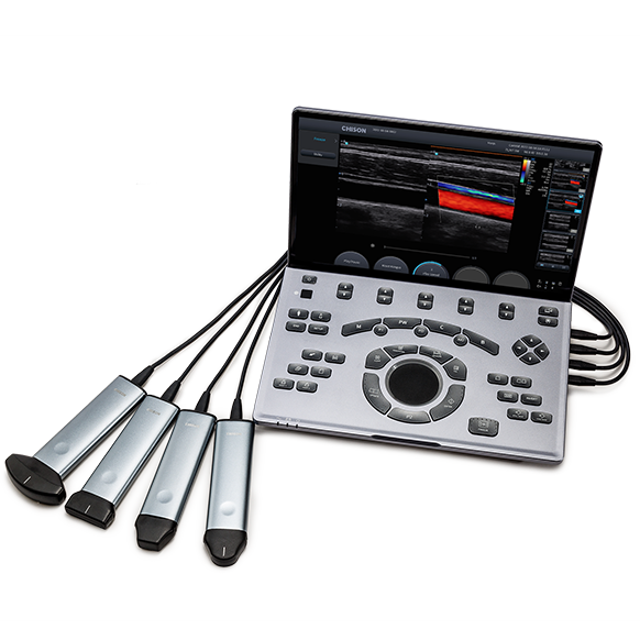 Chison SonoTouch 50 (SonoAir)