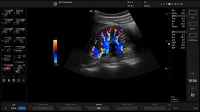 GE Healthcare Versana Active