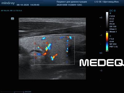 Mindray L12-3E