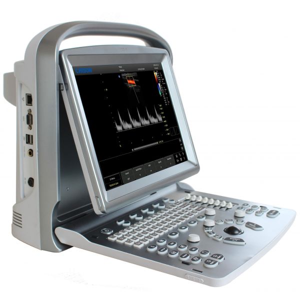 Chison SonoTouch 50