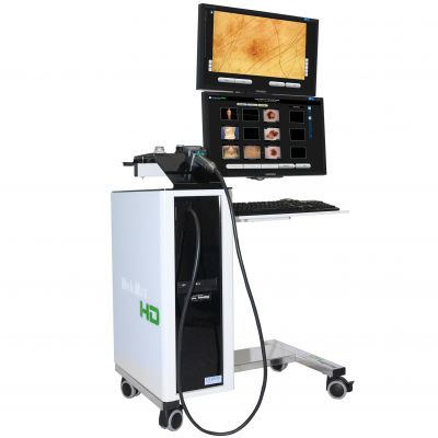Derma Medical System Molemax HD