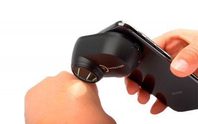 FotoFinder Handyscope NEW