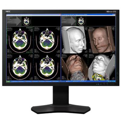 NEC MDview 272