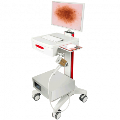 FotoFinder Dermoscope Vexia
