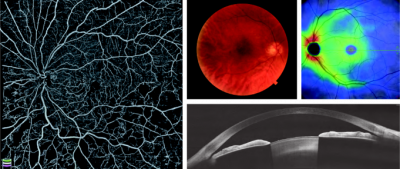 Optovue SOLIX